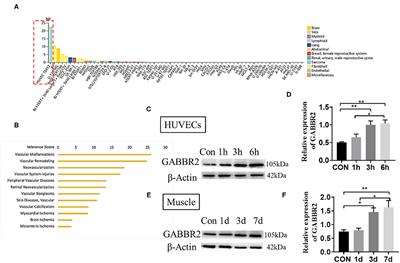 Endothelial GABBR2 Regulates Post-ischemic Angiogenesis by Inhibiting the Glycolysis Pathway
